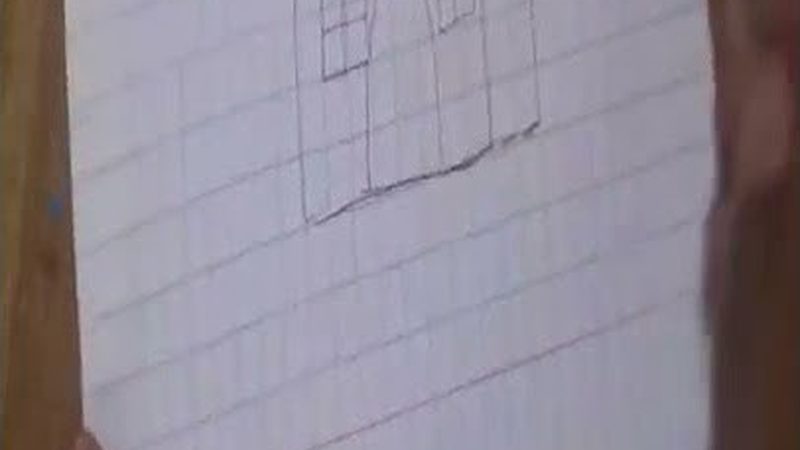 正畸治疗：嘴凸问题能否改善及注意事项